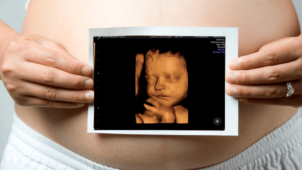 3d 4d ultrasound