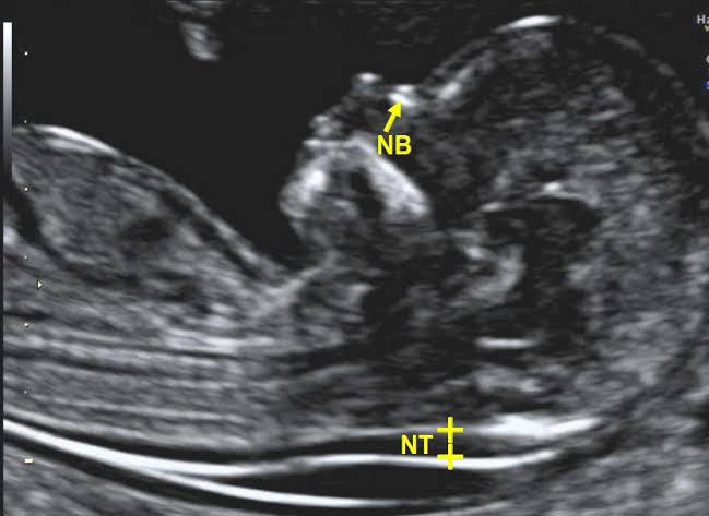 Whatsapp image 2025 05 13 at 23.15.08 93c0845d